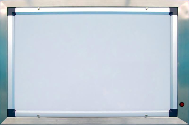 Медицинский Негатоскоп