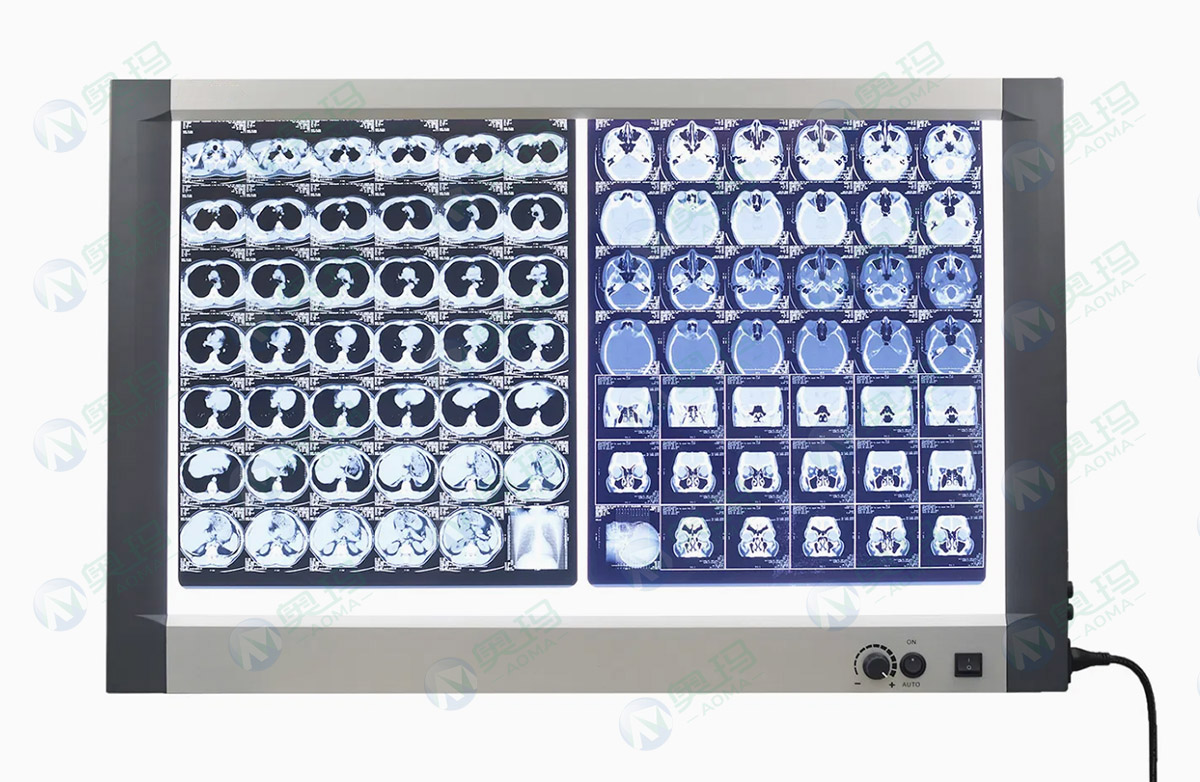 Рентгеновский просмотрщик