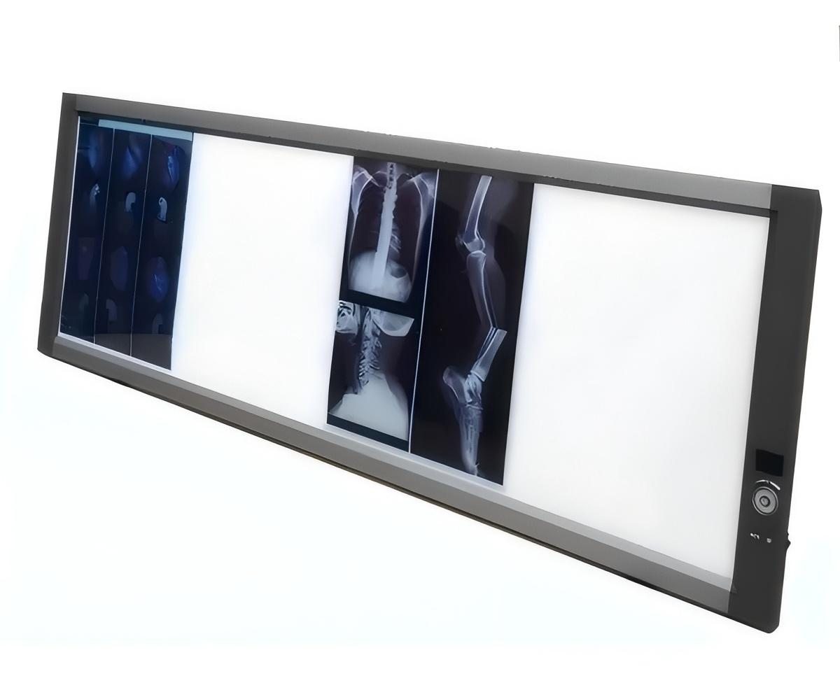 Медицинский Негатоскоп